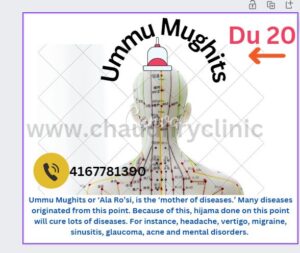 du 20 acupuncture point ummu mughtis