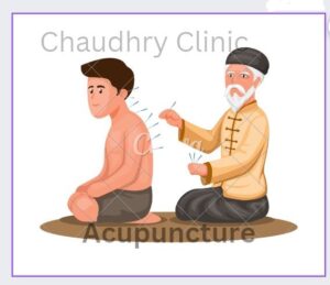 Acupuncture