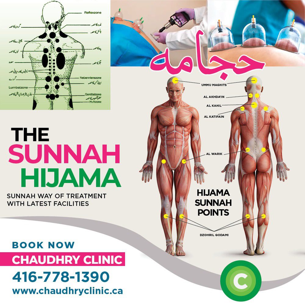 Hijama sunnah points on body