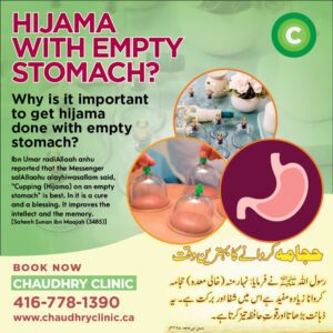 hijama on empty stomach
