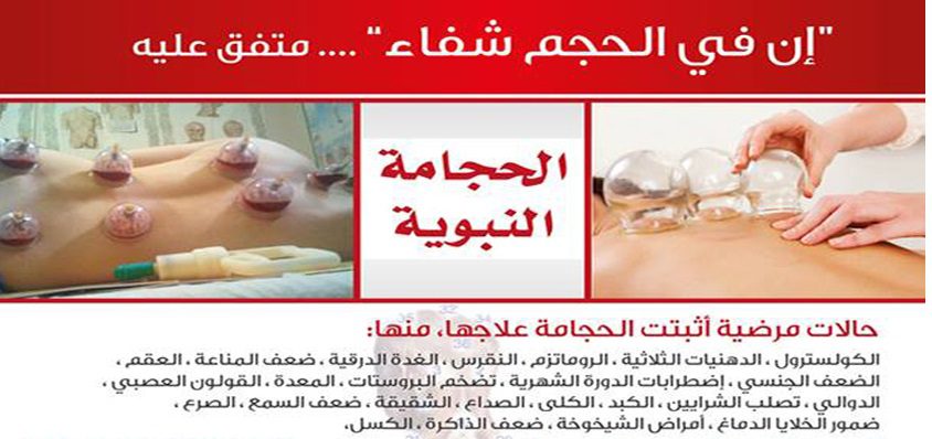 hijama