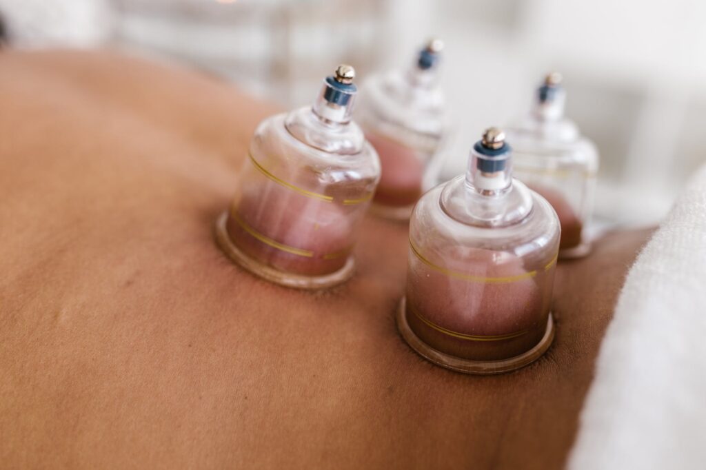 hijama frequently asked question