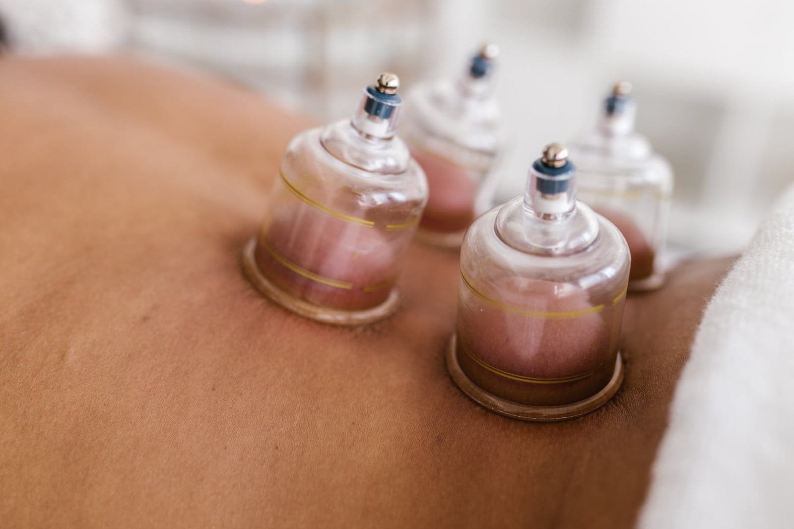 hijama frequently asked question