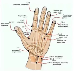 hand acupuncture