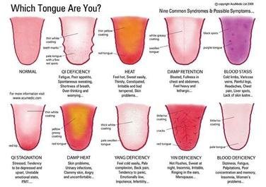 Tongue_syndromes