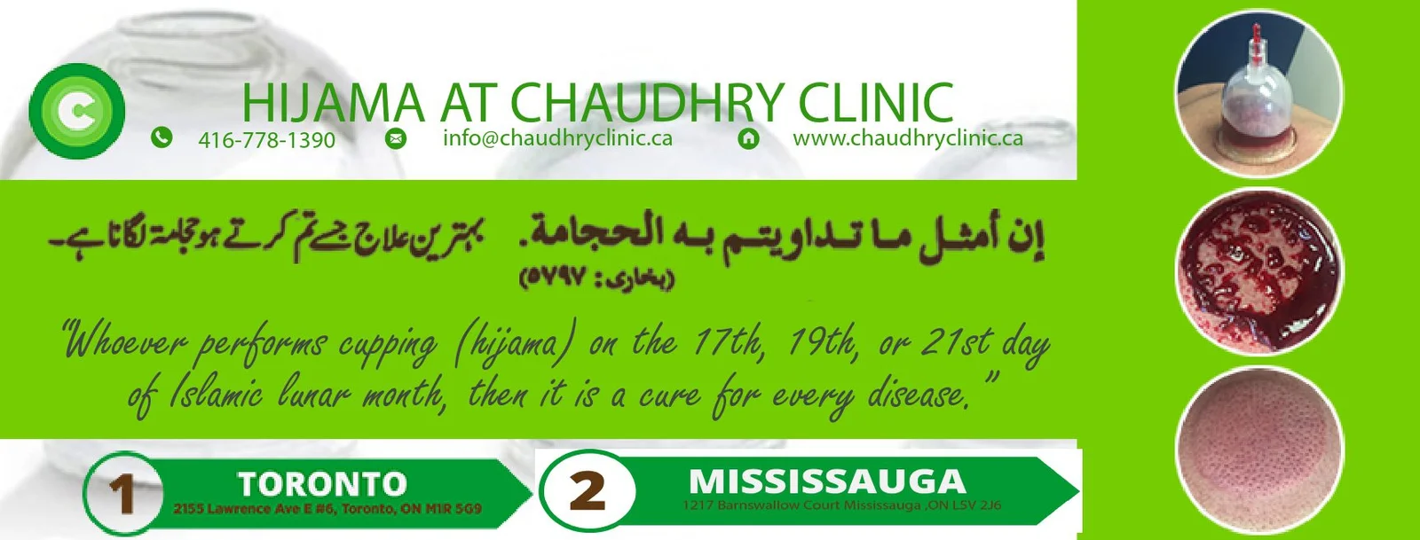 hijama-banner-NEW_page-0001